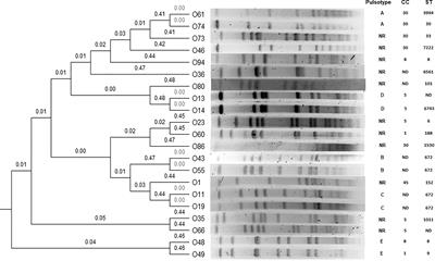 Surveillance of osteoarticular infections caused by Staphylococcus aureus in a paediatric hospital in Mexico City